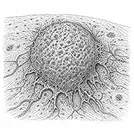 Solid tumors