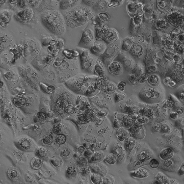ICH M12 DDI Guidelines: The Role of Human Hepatocytes | Preci