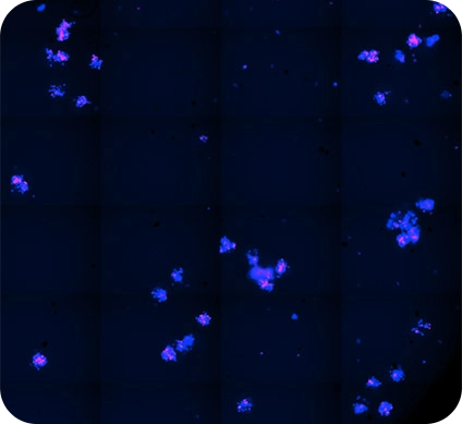 100 micromole/L of carboplatin