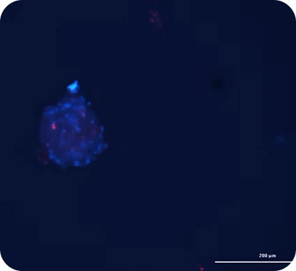 HCC cells. Donor 2 (40 cells/microbead) 3 weeks
