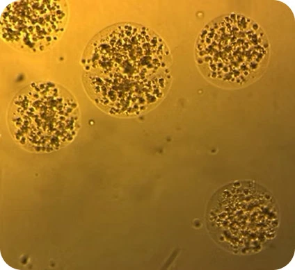 Preci HCC cells Donor 1 Day 1
