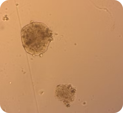 HCC cells. Donor 2 (40 cells/microbead) 2 weeks