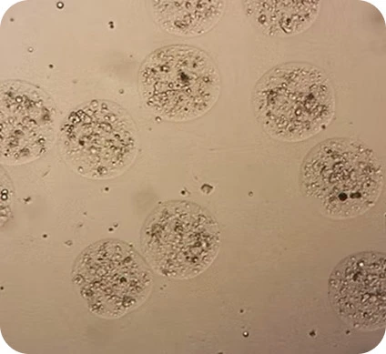 HCC cells. Donor 2 (40 cells/microbead) Day 1