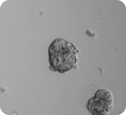 Preci MDA-MB231 (50 cells/ml) 24h of incubation
