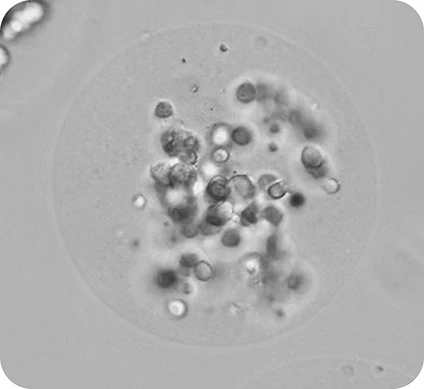 Preci MDA MB231 Recovered from oil