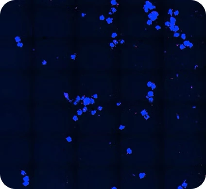 Untreated control - HCC spheroids
