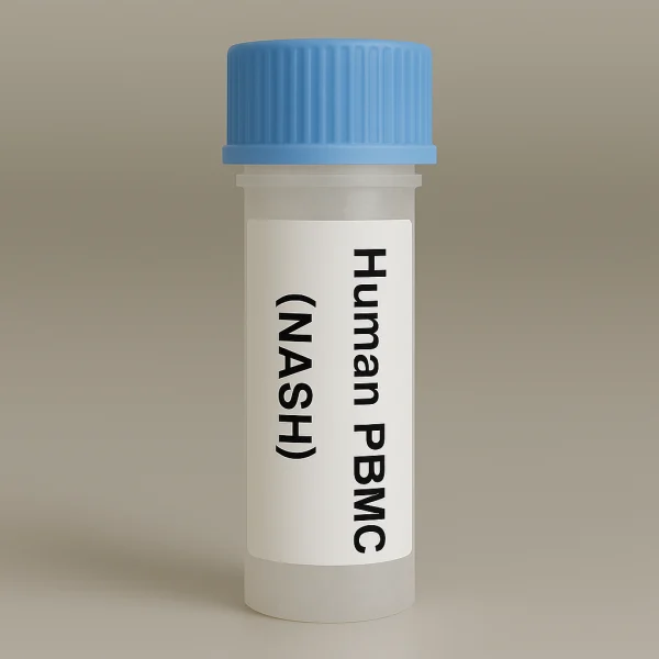 Metabolic Disease-derived PBMC