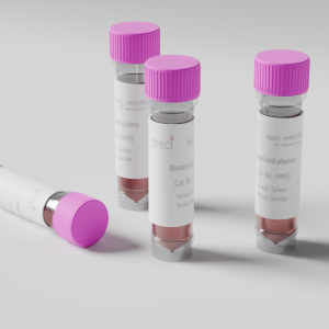 Glioblastoma Cultured Tumoroids