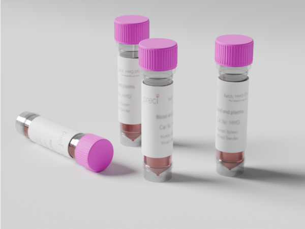 2 Glioblastoma Cultured Tumoroids