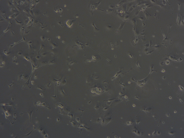 Microscopic image of lung epithelial cells cultured on a collagen matrix.