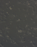 Microscopic image of lung epithelial cells cultured on a collagen matrix.
