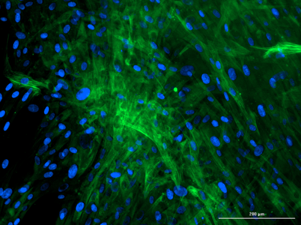 Fluorescent microscopy image showing primary human hepatic stellate cells stained with calcein, highlighting their star-like shape and green cytoplasmic fluorescence.