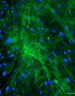 Fluorescent microscopy image showing primary human hepatic stellate cells stained with calcein, highlighting their star-like shape and green cytoplasmic fluorescence.