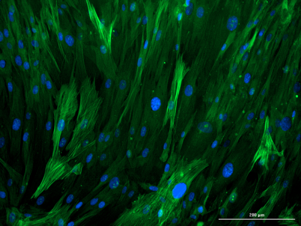 2 Primary Human Stellate Cells calcein am1 Fluorescent microscopy image showing primary human hepatic stellate cells stained with calcein, highlighting their star-like shape and green cytoplasmic fluorescence.