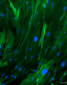 Fluorescent microscopy image showing primary human hepatic stellate cells stained with calcein, highlighting their star-like shape and green cytoplasmic fluorescence.