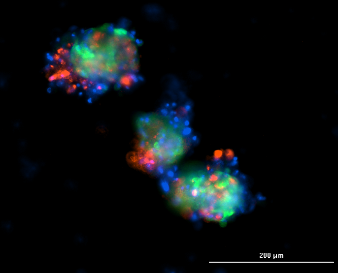 Immunofluorescence micrograph of spheroids stained for alpha-SMA and EpCAM