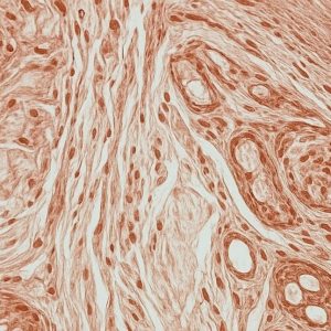 Metabolic disease-derived biospecimens for biomedical research