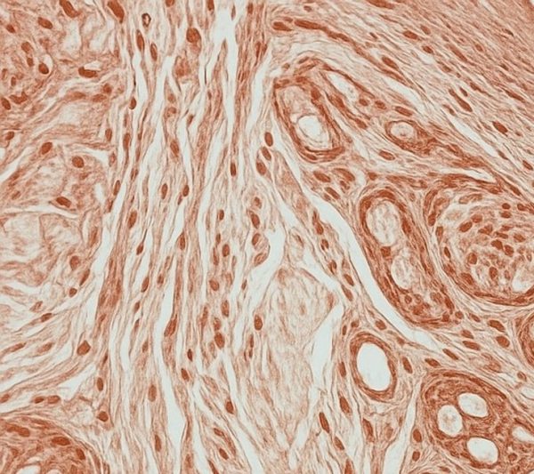 Lung disease-derived biospecimens for respiratory research