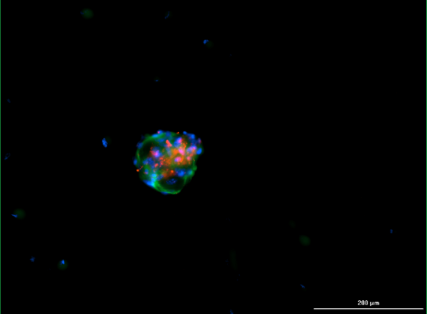 Fluorescent tumoroid image with DAPI, alpha-SMA and EpCAM staining before passaging