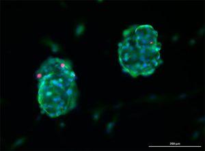 Human ECM for oncology research