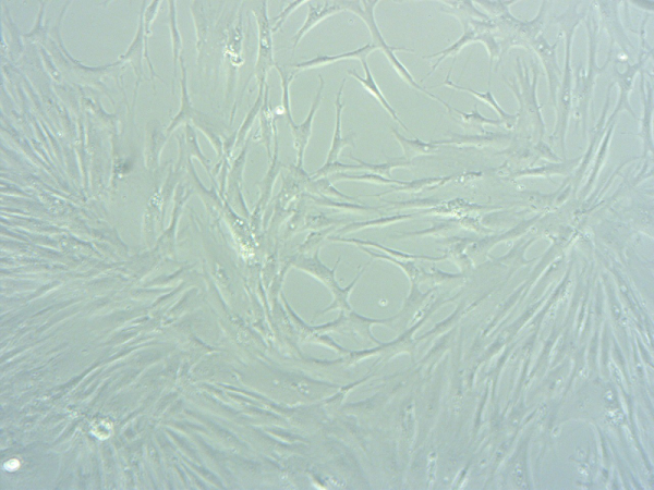 IPF lung fibroblasts Phase contrast micrograph of confluent Human Pulmonary Fibroblasts in culture, displaying elongated spindle-shaped morphology with prominent nuclei and minimal debris.