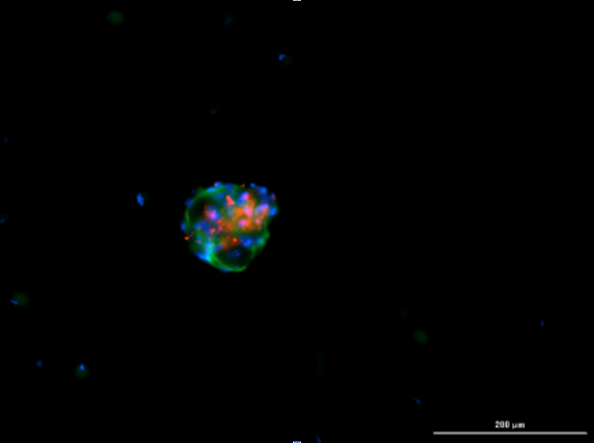 Immunofluorescent image of organoids after passaging day 3 with αSMA, EpCAM and DAPI staining
