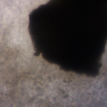 How to Maximize Tissue Slice Viability with HECM Sol-Gel | Preci