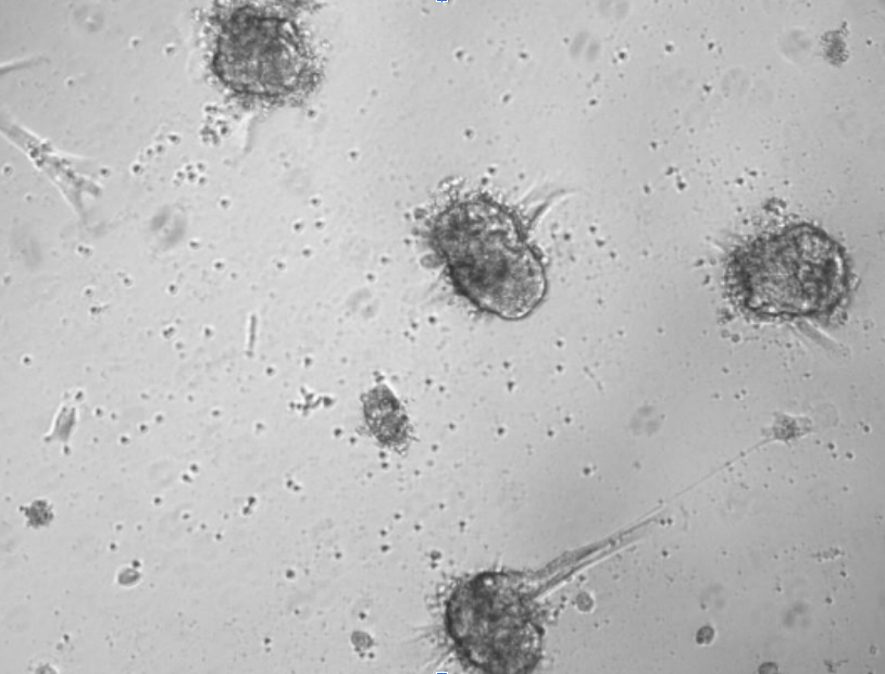 Microscopy image of immature organoids 48 hours after self-assembly in 3D culture