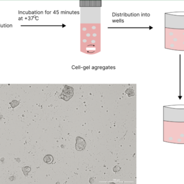 Human ECM Tumoroid Formation Protocol: 3D Cancer Modeling | Preci