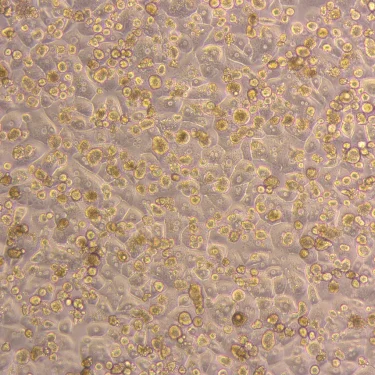 What are the different types of human hepatocytes assays and how are they used?