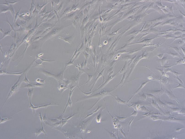 Microscopy image of breast cancer‑associated fibroblasts (CAFs), showing elongated, spindle‑shaped cells in a cell culture dish.