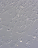 Microscopy image of breast cancer‑associated fibroblasts (CAFs), showing elongated, spindle‑shaped cells in a cell culture dish.