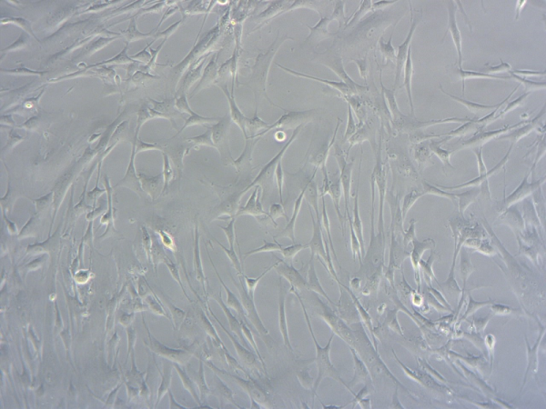 Brightfield microscopy image of cardiac fibroblasts, showing elongated, spindle‑shaped cells in culture.
