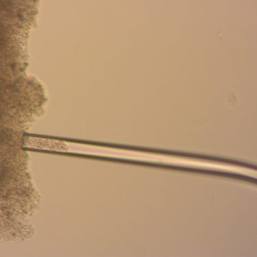 Measuring Young’s Modulus via Micropipette Aspiration Protocol