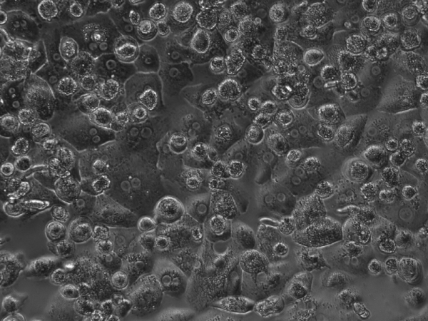 Human primary hepatocytes in culture, high‑resolution microscopy image showing polygonal liver cells with distinct nuclei and cell borders.