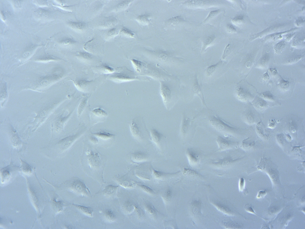 Brightfield microscope image of astrocytes showing star-shaped morphology with branching processes.