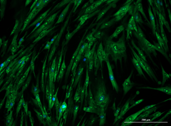 Fluorescence image of lung fibroblasts stained with SYTO 14, showing nucleic acid‑positive cells in green.
