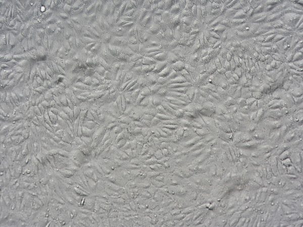 Microscopic brightfield view of renal glomerular endothelial cells.