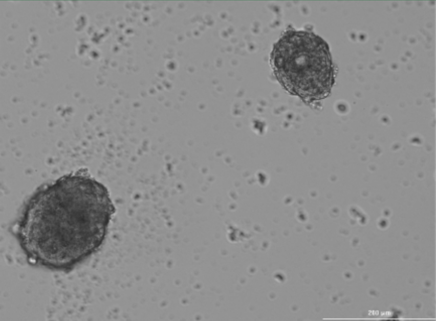 Spheroids after passaging following 48 hours of growth in 3D culture