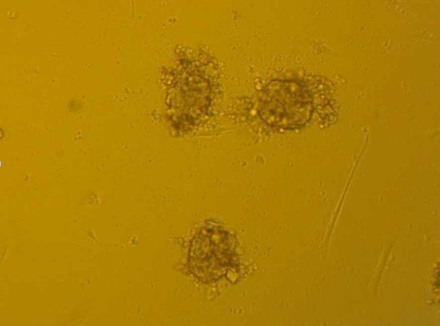 Spheroids in 3D culture before passaging