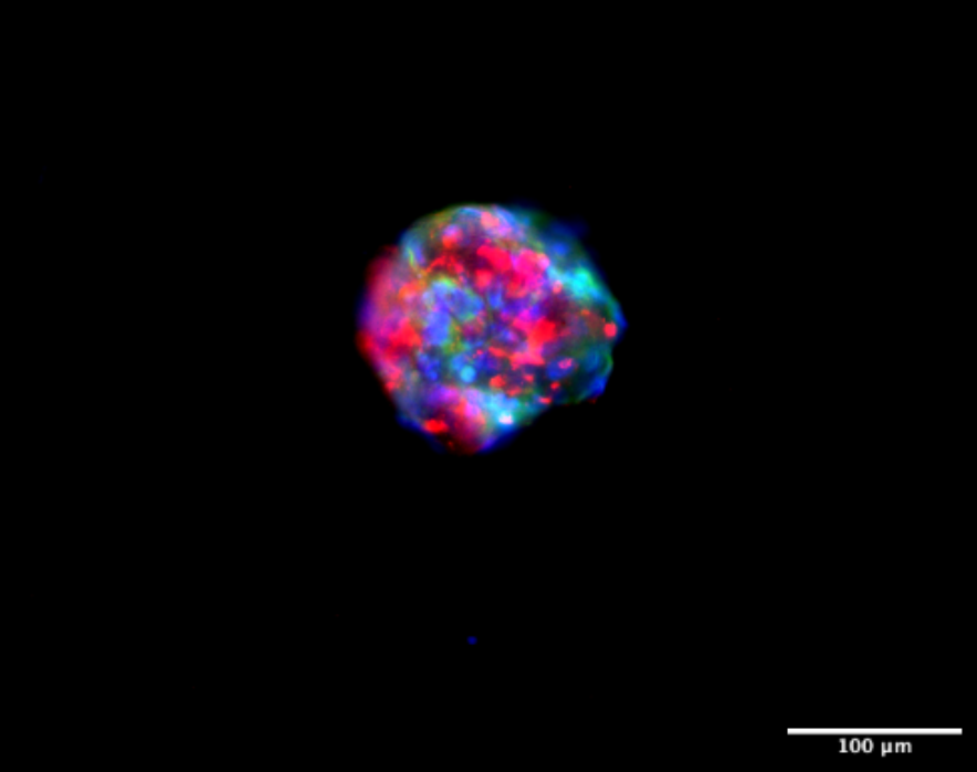 Immunofluorescence staining of 3D spheroids showing alpha-SMA and EpCAM markers with DAPI nuclear counterstain