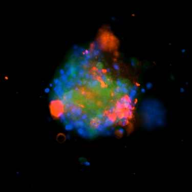 3D Spheroid Immunofluorescence Protocol and Optimization