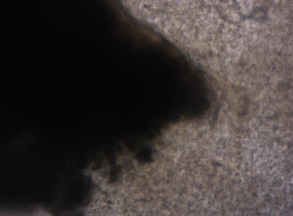 Microphotograph of tissue in the HECM, 100x magnification