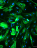 Immunofluorescence image of colon cancer‑associated fibroblasts (CAFs) stained for α‑SMA, highlighting the actin‑positive fibroblast cytoskeleton.