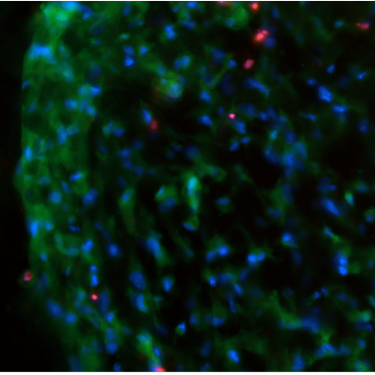 Multilevel complexity of cell-matrix interaction