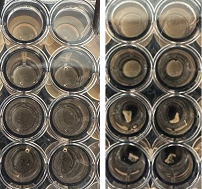 Cell–ECM disk contraction after 3 days of incubation.