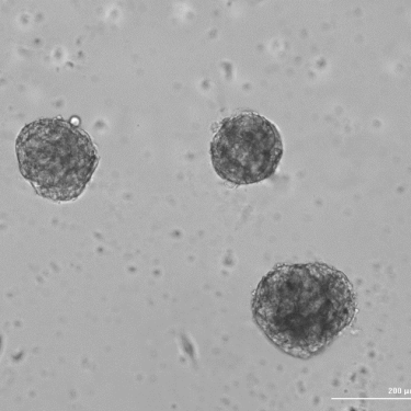 Human ECM in drug development: Building more physiologically relevant in vitro models