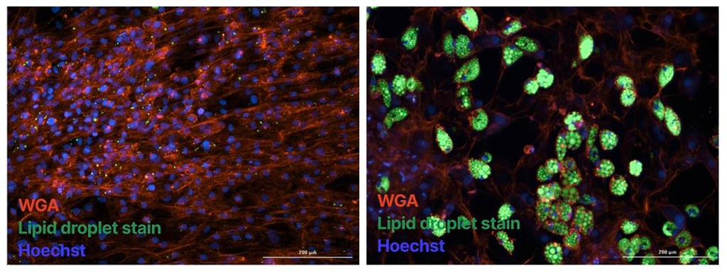 Fluorescence images of primary human preadipocytes showing lipid droplet accumulation during adipogenic differentiation, with WGA, lipid droplet stain, and Hoechst labeling.