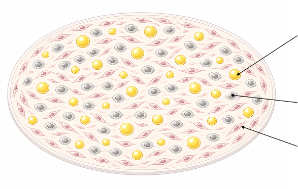 Complete donor heart microenvironment model containing adipocytes, microvascular endothelial cells, fibroblasts, and human-derived cardiac ECM