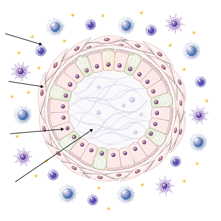ECM-embedded intestinal assembloid containing PBMCs, fibroblasts, epithelial cells, and extracellular matrix